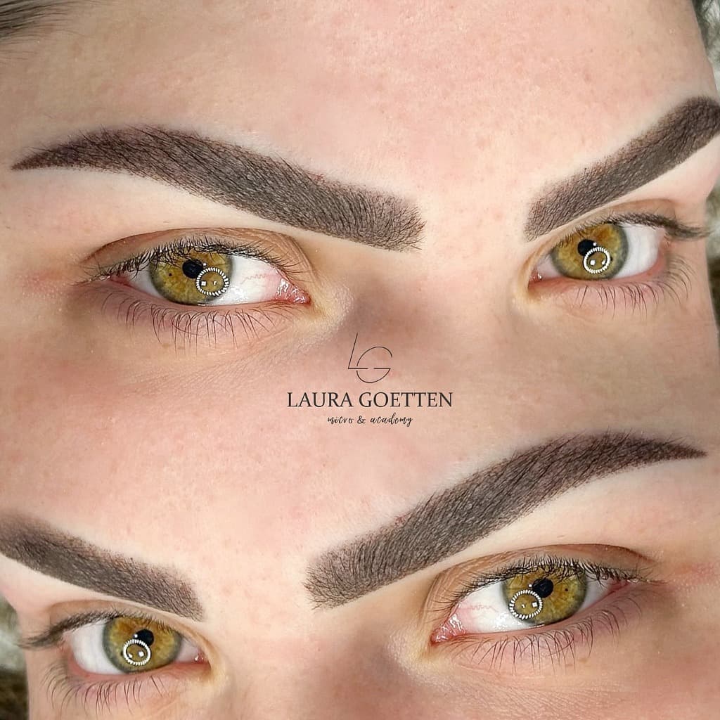 Fios ou Shadow: Qual a Melhor Escolha?